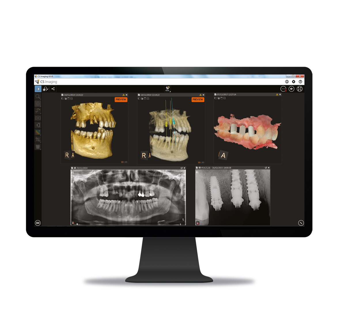 CS Imaging Client/Server